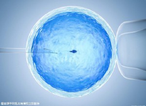 无精症案例